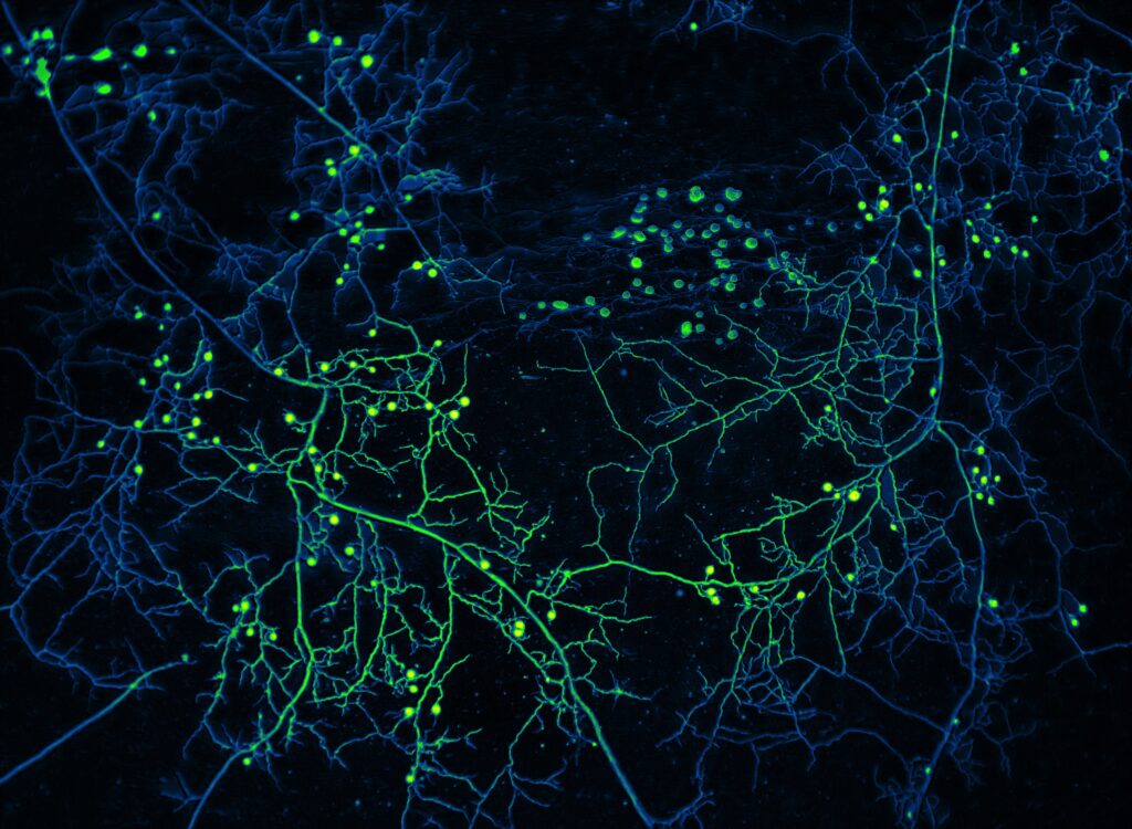 Close-up image of the mycelial network formed by Rhizophagus irregularis, an arbuscular mycorrhizal fungis.